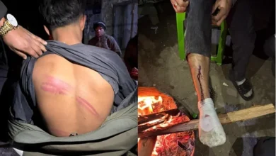 Outrage Erupts After Muslim Youngster Is Allegedly Tortured by Vigilante Gang in Imphal.