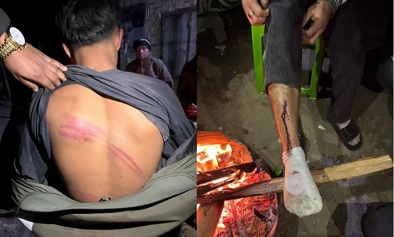 Outrage Erupts After Muslim Youngster Is Allegedly Tortured by Vigilante Gang in Imphal.